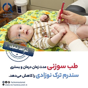 راستی‌آزمایی: طب سوزنی مدت زمان درمان و بستری نوزادان مبتلا به سندرم ترک نوزادی را کاهش می‌دهد.