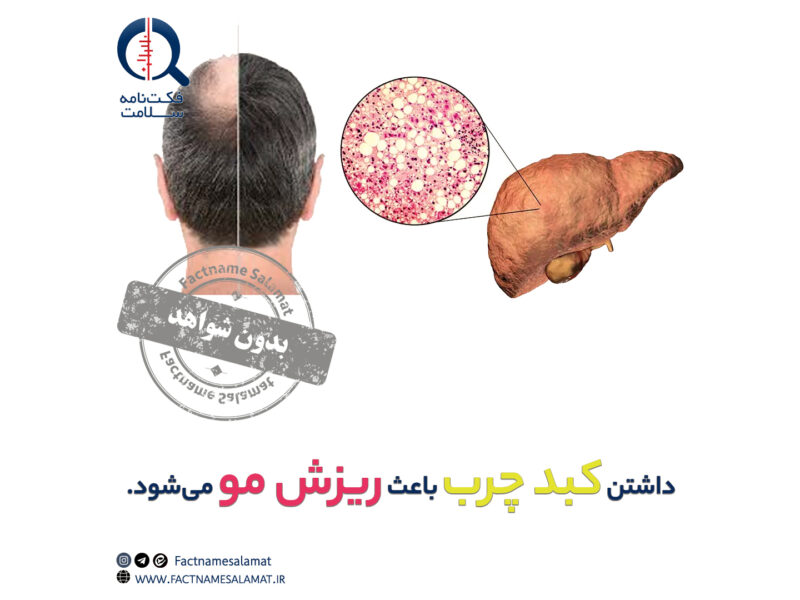 راستیآزمایی: کبد چرب باعث ریزش مو میشود.